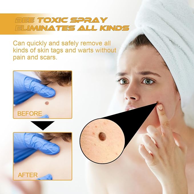 Organic Tag Recede Bee Venom Spray